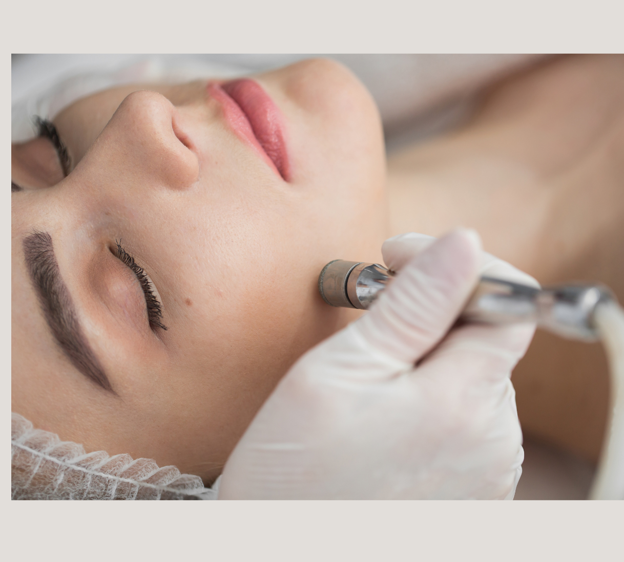 Diamond Peel Facial